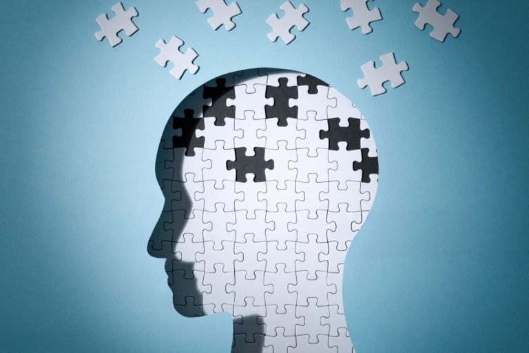 記憶喪失のイメージ